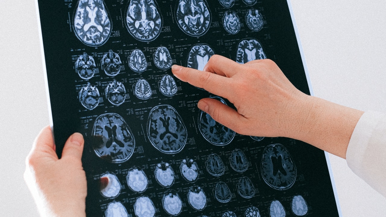 How does Functional Neurology work?