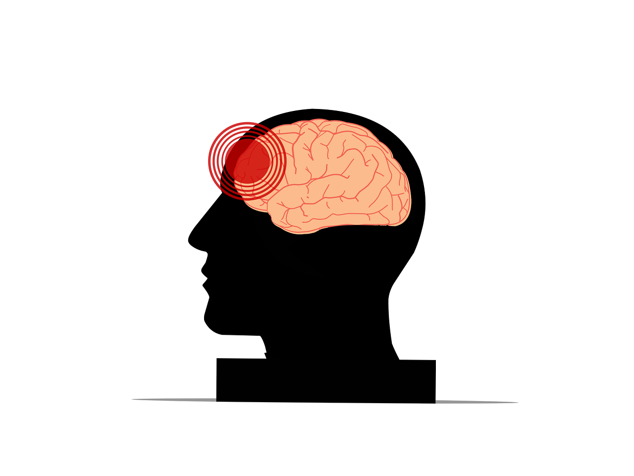 How to diagnose a concussion