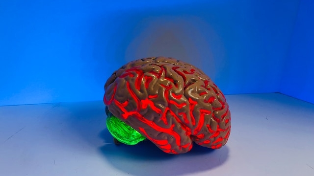 What are the Symptoms of a Slow Brain Bleed?